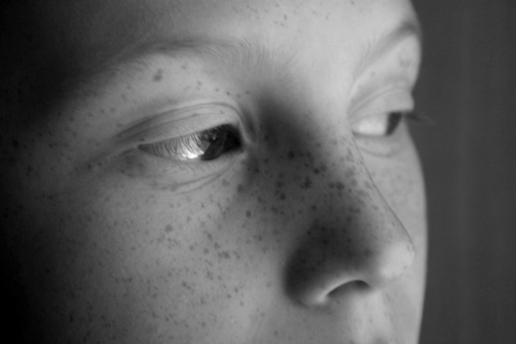 un visage couvert de taches de rousseur