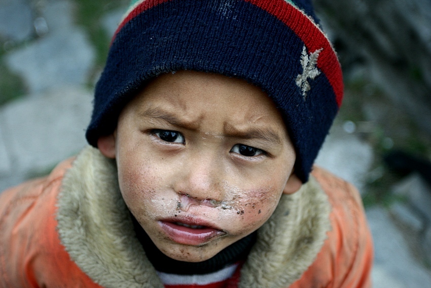 Nepal